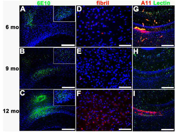 Immunofluorescence using Aβ40 oligomers